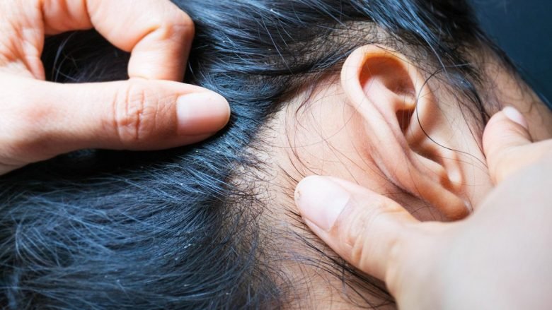 ¿CÓMO SE PROPAGA EL BROTE? Los piojos adultos viven alrededor de 30 días. Se reproducen muy rápido, y pueden llegar a poner (la hembra) hasta 10 huevos diarios, que generalmente se encuentran cerca de la raíz del pelo, pegados al cuero cabelludo. ¿CÓMO VENCERLOS? Cuando detectéis piojos en la cabeza de vuestro hijo/a, debéis utilizar un tratamiento para eliminarlos. Para asegurarnos de que no queda ningún huevo, se aconseja repetir el tratamiento al cabo de 7 días. CONSEJOS PARA LA PREVENCIÓN Los piojos pueden afectar cualquier persona, independientemente del nivel social o higiene personal. No vuelan ni saltan; por lo tanto, el contacto de cabeza en cabeza es la forma más común de propagación. Compartir cepillos, gorras, bufandas... también es una vía de transmisión. Las lociones pediculicidas sirven para tratar, no para prevenir.   Fuente: Revista fedefarma número 30