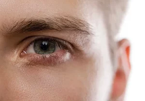 Factores desencadenantes del ojo seco 1. En el contexto de la baja producción de Alarmaes Los desequilibrios hormonales, el envejecimiento, la medicación o ciertas enfermedades autoinmunes se acompañan a veces de una reducción de la producción de lágrimas. La falta de Omega 3 en la dieta también es una causa de la disminución de la producción de lágrimas. La cirugía también puede conducir a la falta de lágrimas después. 2. En el contexto de una evaporación demasiado rápida de las lágrimas Hay muchas causas que pueden desencadenar la inflamación del ojo y el ojo seco. Entre ellas se encuentran: - Inflamación crónica de los párpados (blefaritis). En este caso, la película lagrimal está desprovista de lípidos y ya no tiene las cualidades necesarias para proteger la superficie del ojo - Factores ambientales: contaminación, entornos urbanos, humo, aire acondicionado (por ejemplo, conducir de noche en viajes largos en un coche con aire acondicionado es un factor de sequedad ocular) - El viento, el polvo y el polen son fuentes de irritación ocular que pueden provocar un intenso picor e inflamación de los párpados - Trabajo prolongado con pantallas, uso de lentes de contacto - El uso de una mascarilla, que provoca mecánicamente la sequedad del ojo debido al aliento que llega a los ojos a lo largo del día