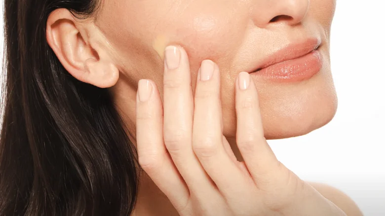 Comprar gh 0.3 Retinol-NP Sérum de Gema Herrerías en Gran Farmacia Andorra es un tratamiento facial antiedad formulado para combatir las arrugas, la flacidez y las manchas. Características principales Formulación: Contiene 0,3 % de retinol puro, 4 % de niacinamida (NP) y hexapéptido-10, además de extractos de manzanilla y flores blancas con propiedades calmantes y antioxidantes. Indicaciones: Mejora la firmeza, la elasticidad, las arrugas de expresión y la textura irregular de la piel. Apto para todo tipo de pieles (con precaución en pieles sensibles); está contraindicado durante el embarazo y la lactancia. Modo de empleo: Se aplica por la noche, de 4 a 5 gotas sobre la piel limpia y seca de forma progresiva. Se debe evitar el contorno de ojos, las comisuras, las aletas nasales y el cuello. Es imprescindible usar protector solar facial a la mañana siguiente.  Formato: Envase de 30 ml. Punto de venta local: Puedes encontrarlo disponible en la Gran Farmacia Andorra